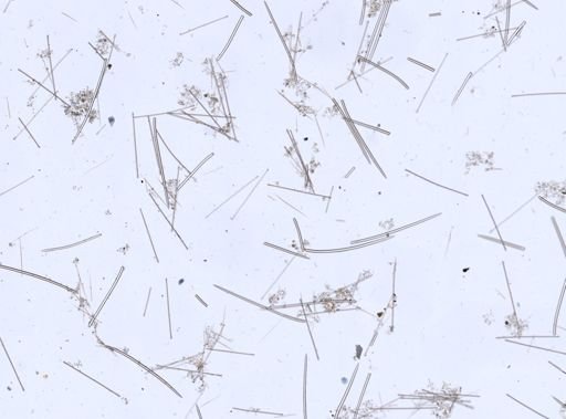 Tedania suctoria
