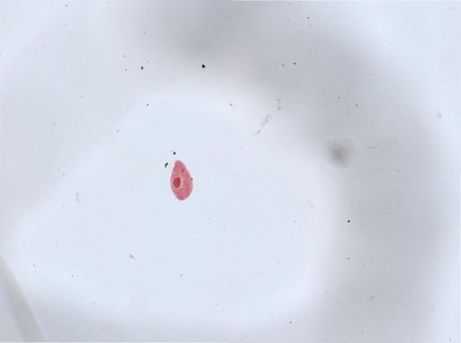 Paramecium aurelia