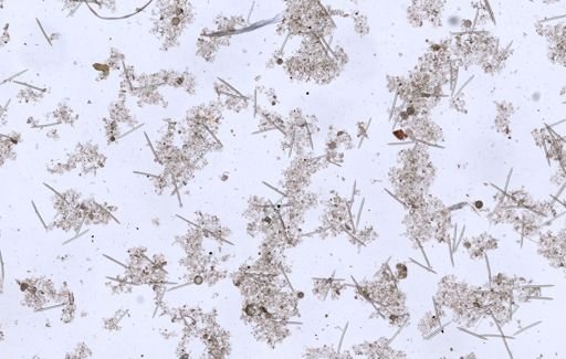 Haliclonidae