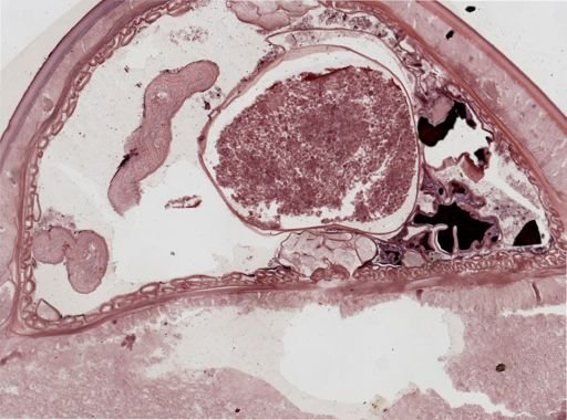 Echinorhynchus gigas