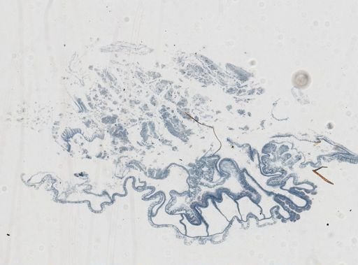 Astrangia poculata
