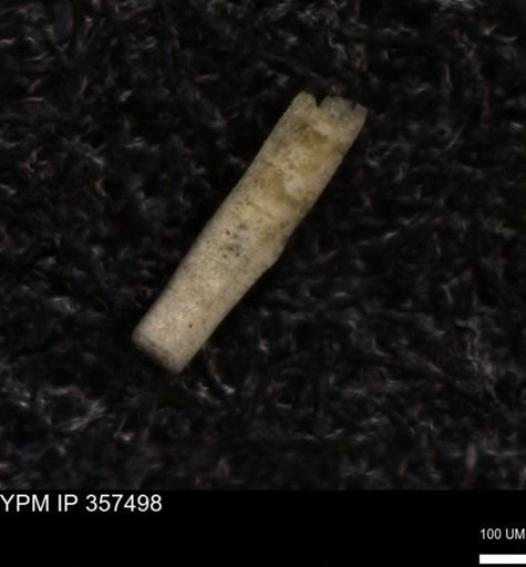 Echinoidea?