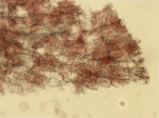 Haliclona oculata