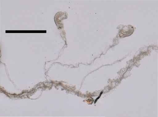 Athorybia rosacea