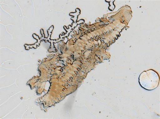 Onchidoris muricata