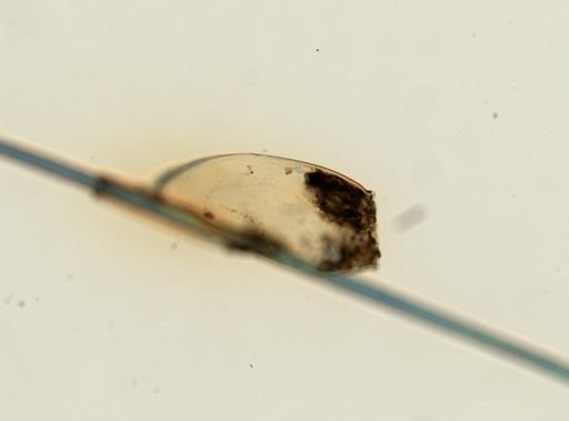 Pediculus humanus