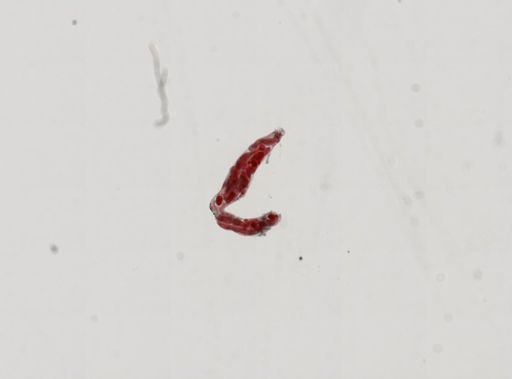 Trematoda