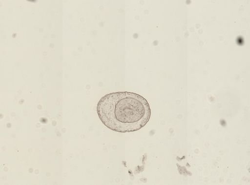 Dicrocoelium dendriticum