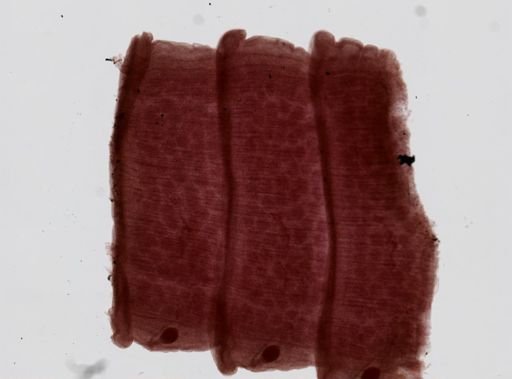 Raillietina cesticillus
