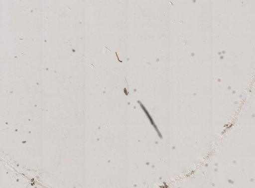 Paramecium