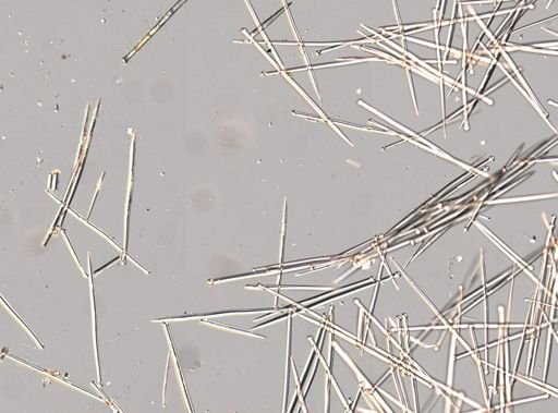 Suberites sp.