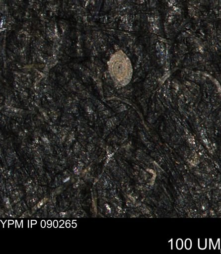 Spirolocammina sp.