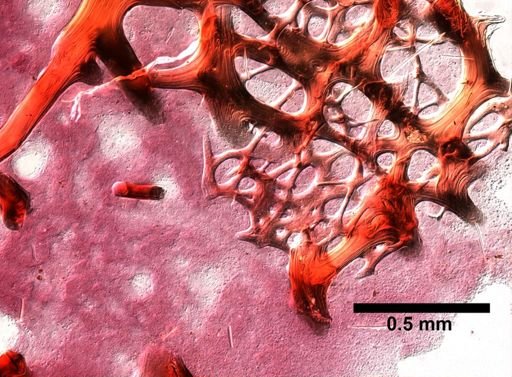 Hymedesmia arndti