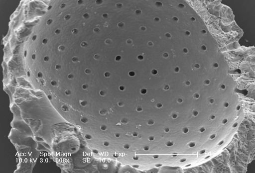 Globigerinoides sacculifer