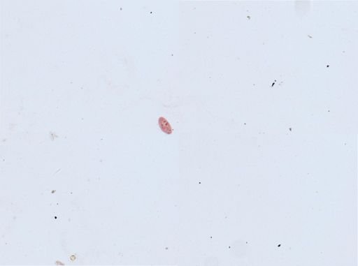 Paramecium polycaryum