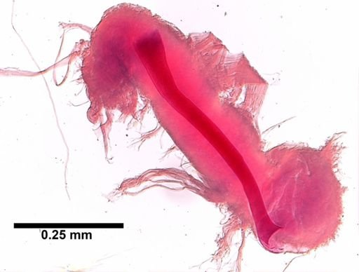 Limnodrilus hoffmeisteri