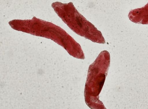 Fasciola hepatica