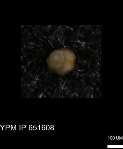 undet. Foraminiferida