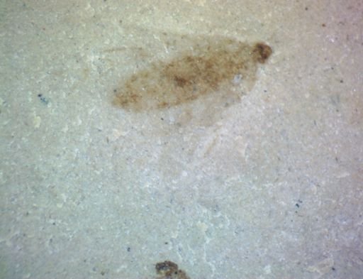 undet. Hexapoda