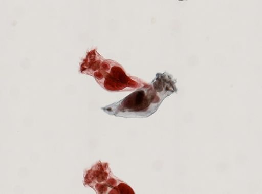 Epiphanes senta