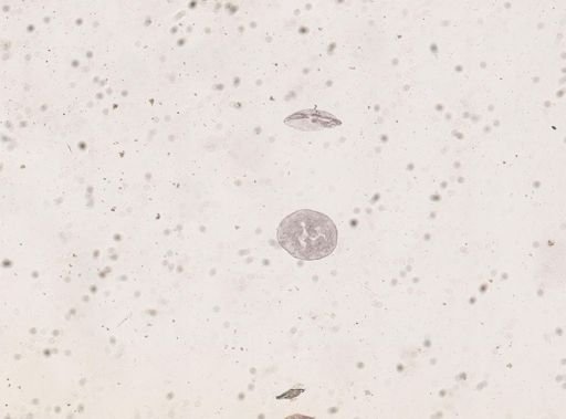Blatta orientalis