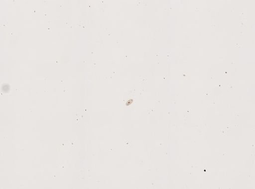 Paramecium trichium