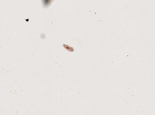 Paramecium multimicronucleatum