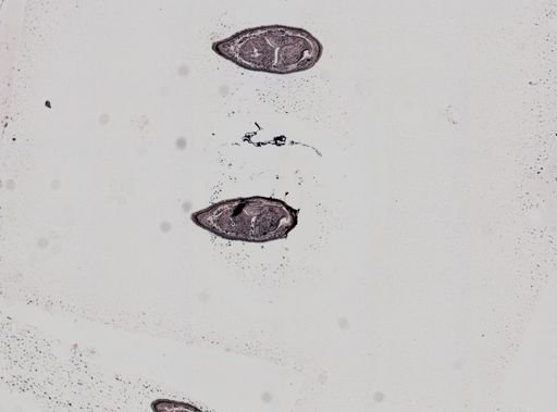 Plagiostomum whitmani