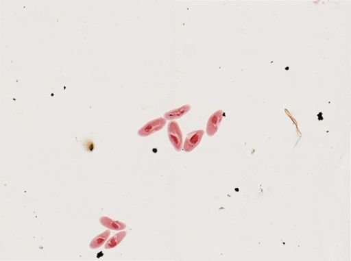 Paramecium calkinsi