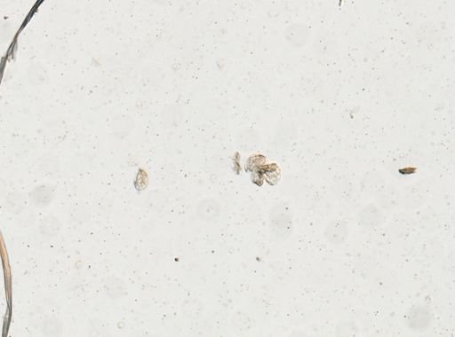 Schistosoma japonicum