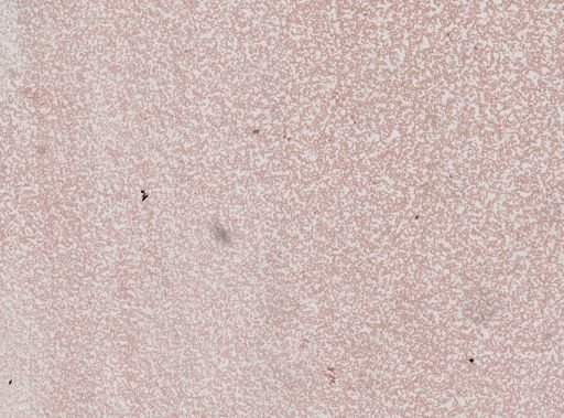 Plasmodium falciparum