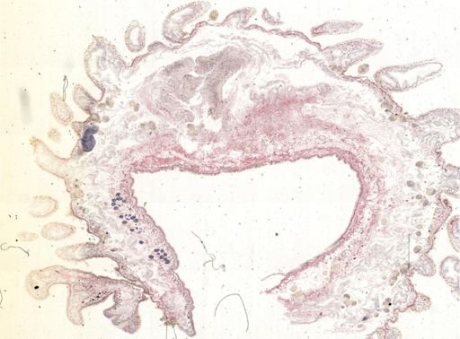 Thysanozoon brocchii
