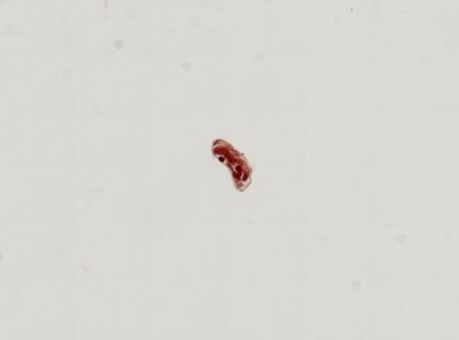 Trematoda