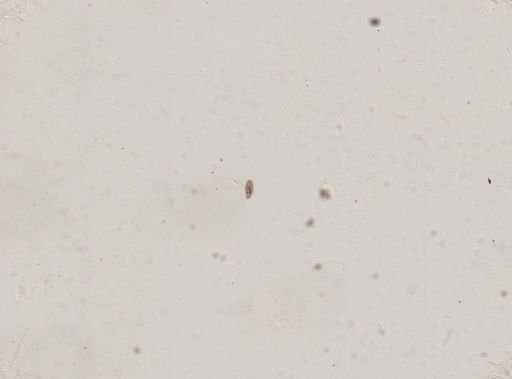 Paramecium