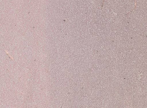 Plasmodium falciparum