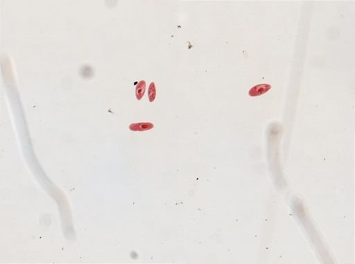 Paramecium calkinsi