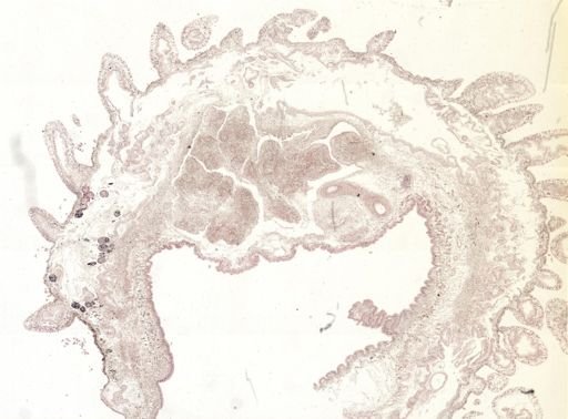 Thysanozoon brocchii