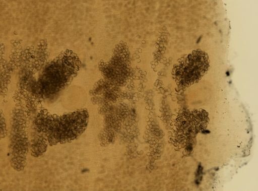 Diphyllobothrium latum