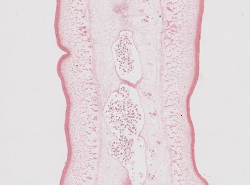 Taenia saginata