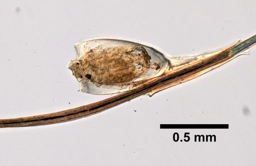 Pthirus pubis