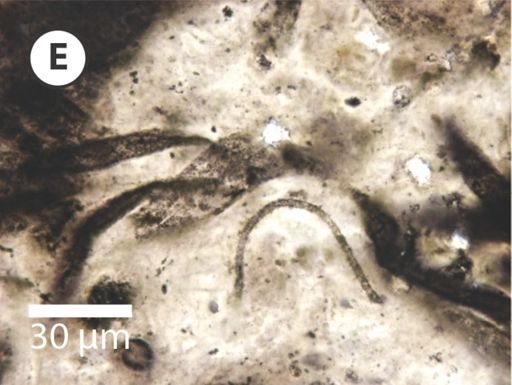 Siphonophycus