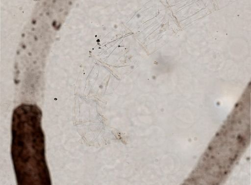 Tanypodinae