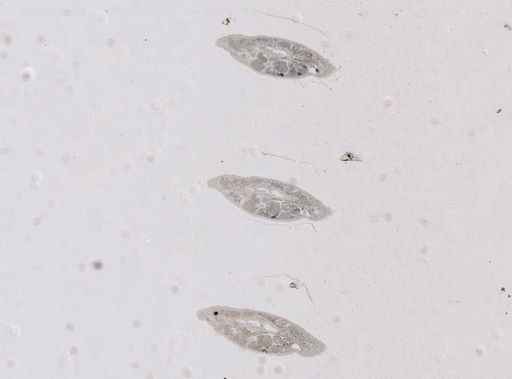 Paravortex gemellipara